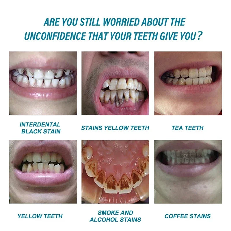 Dream Tune Smile Stain Removal Toothpaste – Smoke, Tea & Coffee Stain Eliminator