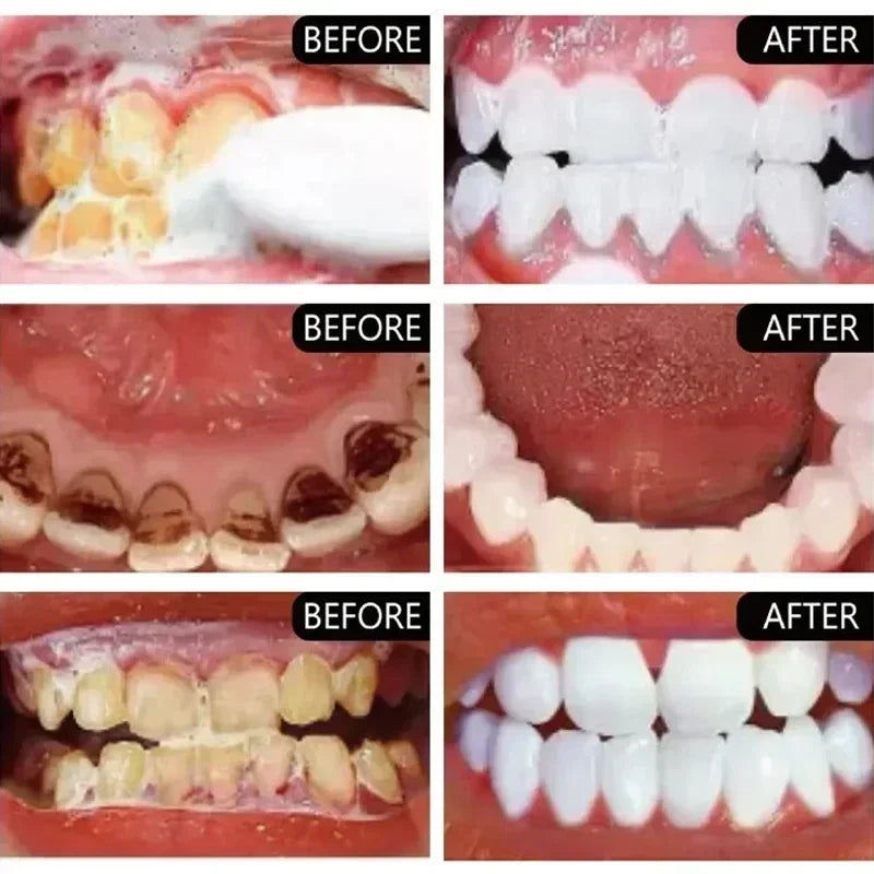 Dream Tune Smile Stain Removal Toothpaste – Smoke, Tea & Coffee Stain Eliminator
