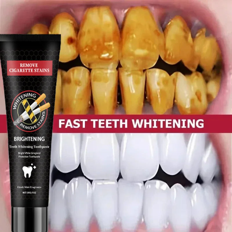 Dream Tune Smile Stain Removal Toothpaste – Smoke, Tea & Coffee Stain Eliminator