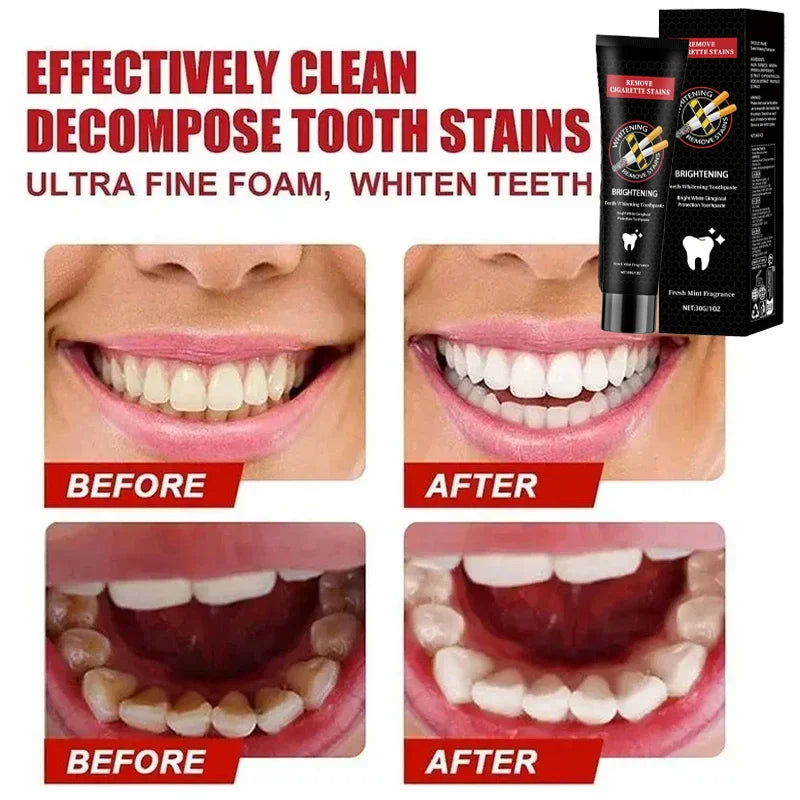 Dream Tune Smile Stain Removal Toothpaste – Smoke, Tea & Coffee Stain Eliminator