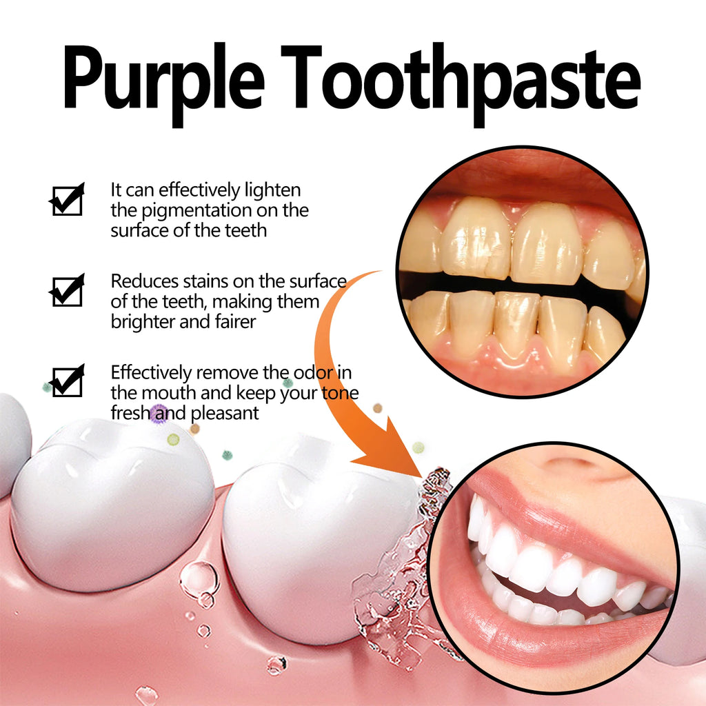 Dream Tune Smile Purple Whitening Toothpaste 50g – 3-Day Stain Removal & Plaque Reduction