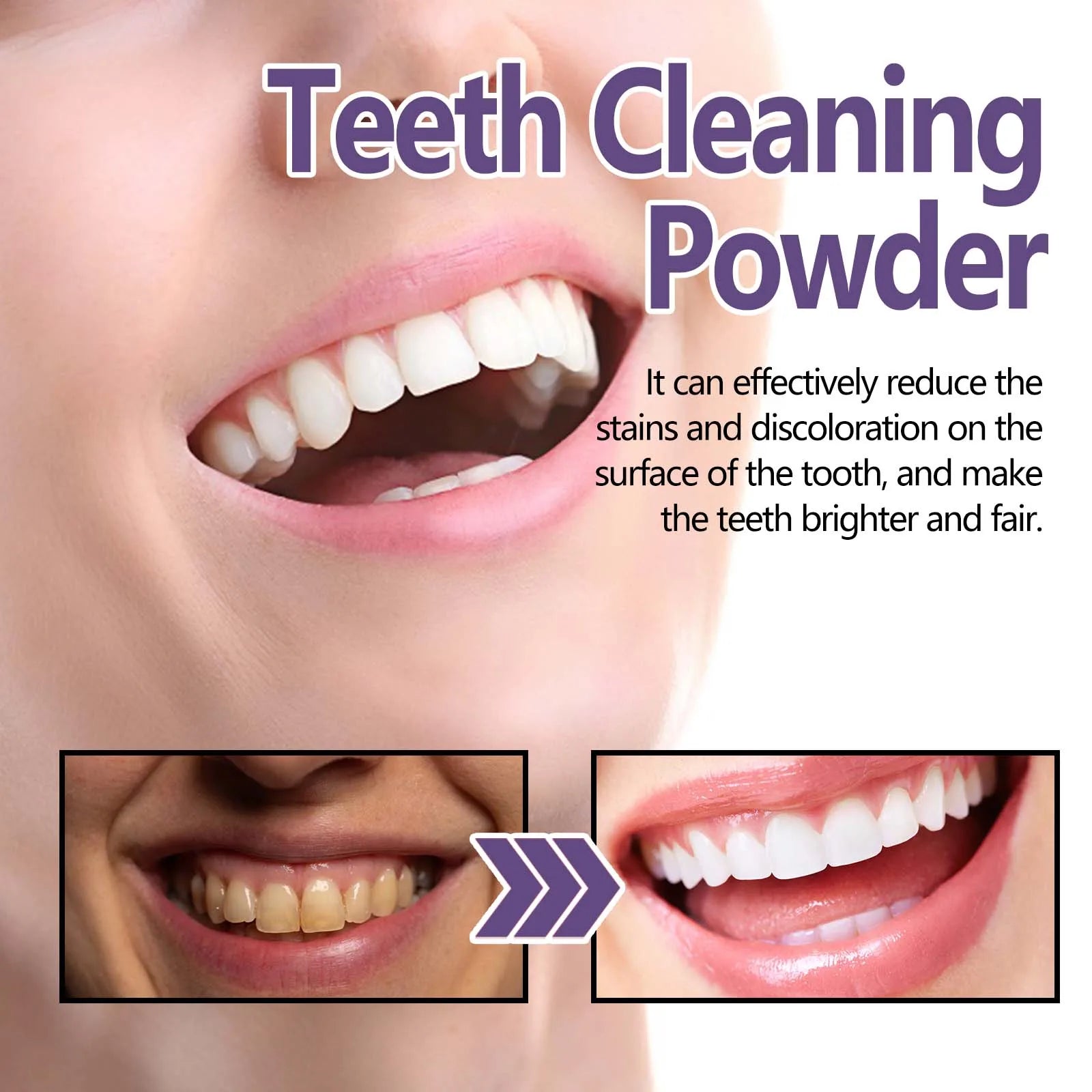 Dream Tune Smile Purple Whitening Toothpaste 50g – 3-Day Stain Removal & Plaque Reduction
