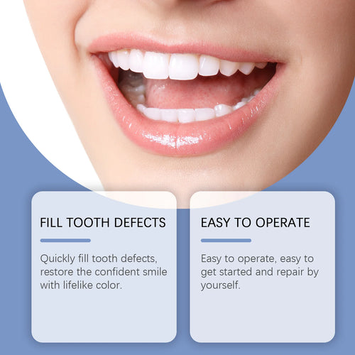 Dream Tune Smile At-Home Tooth Repair Kit – With Blue LED Curing Light