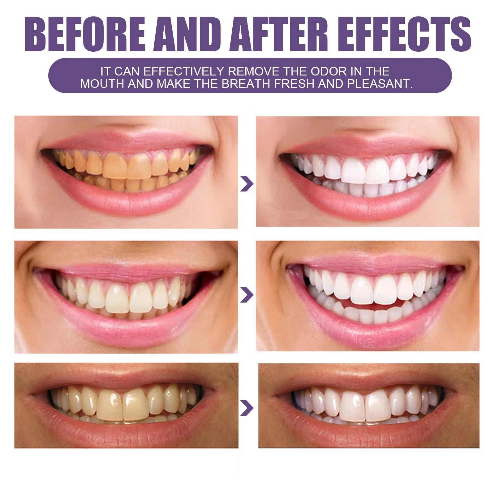 Dream Tune Smile Purple Whitening Toothpaste 50g – 3-Day Stain Removal & Plaque Reduction
